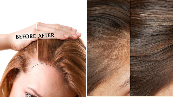 Revive Your Locks with Hair Loss Serum